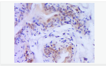 60543c729d3cd.png image.png