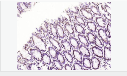 60546103ae8f5.png image.png