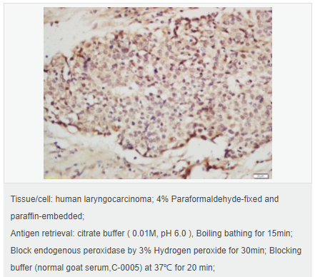 60546112585e0.png image.png