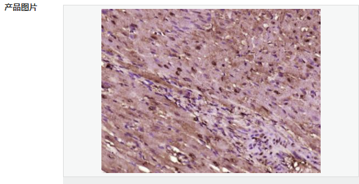 6059462e7dfe5.png image.png