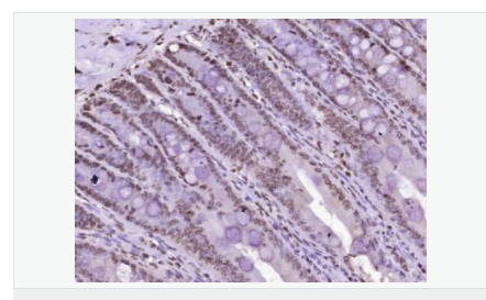 6066d74d0f9f1.png image.png