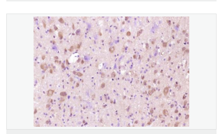 6076405f16fe2.png image.png