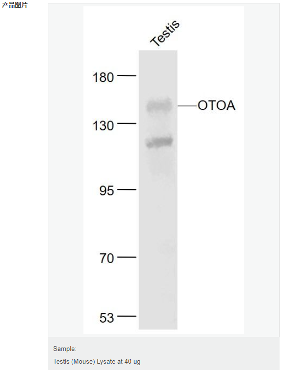 6078e6dc380d8.png image.png