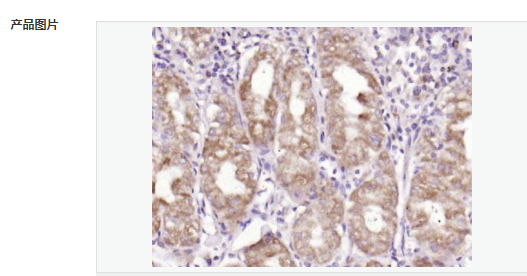 607957b46023c.png image.png